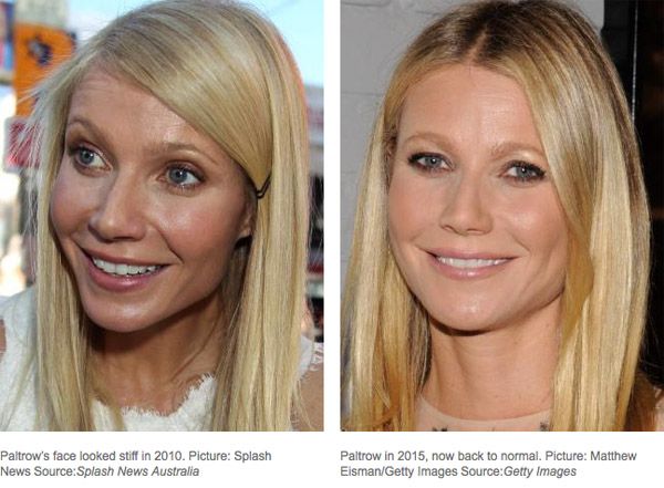 stars-who-regret-their-plastic-surgery